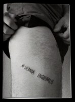 Hernia Inguinalis