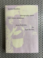 Spotted Realities